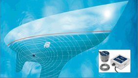 Ultrasonic Antifouling System, kekamoz derdine son veriyor